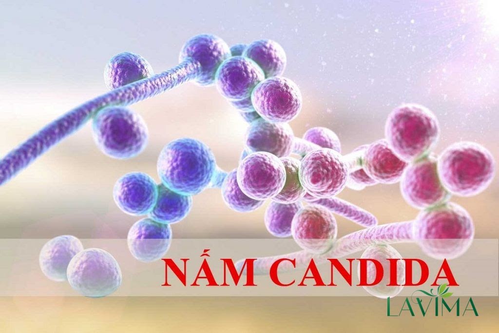 Nấm âm đạo là bệnh gì?