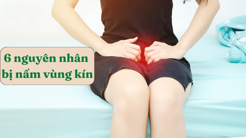 6 nguyên nhân bị nấm vùng kín bạn không nên bỏ qua
