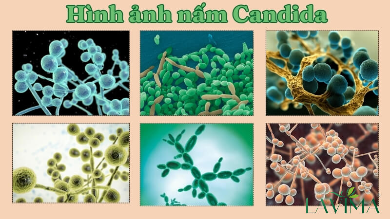 Hình ảnh nấm Candida và cách thử nấm đơn giản bạn cần biết