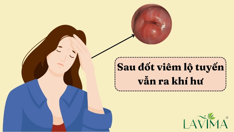 Sau Đốt Viêm Lộ Tuyến Vẫn Ra Khí Hư: Nguyên Nhân Và Cách Khắc Phục Hiệu Quả